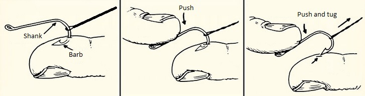 http://www.scoutsociety.org/images/repository/first-aid/fishhook.jpg